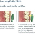 mezizubní kartáčky